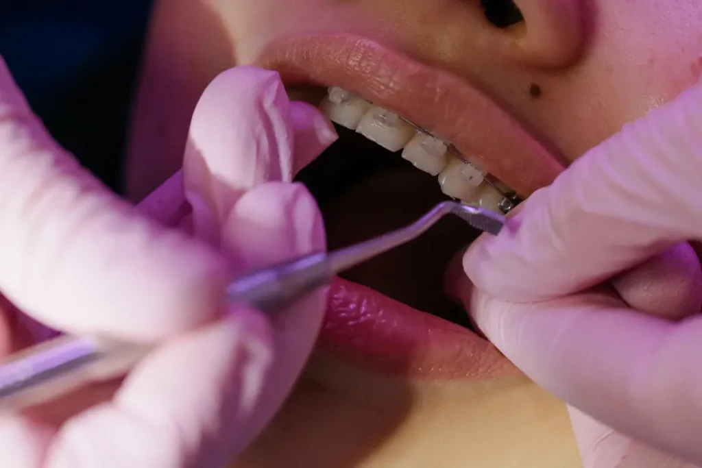 adult getting braces
