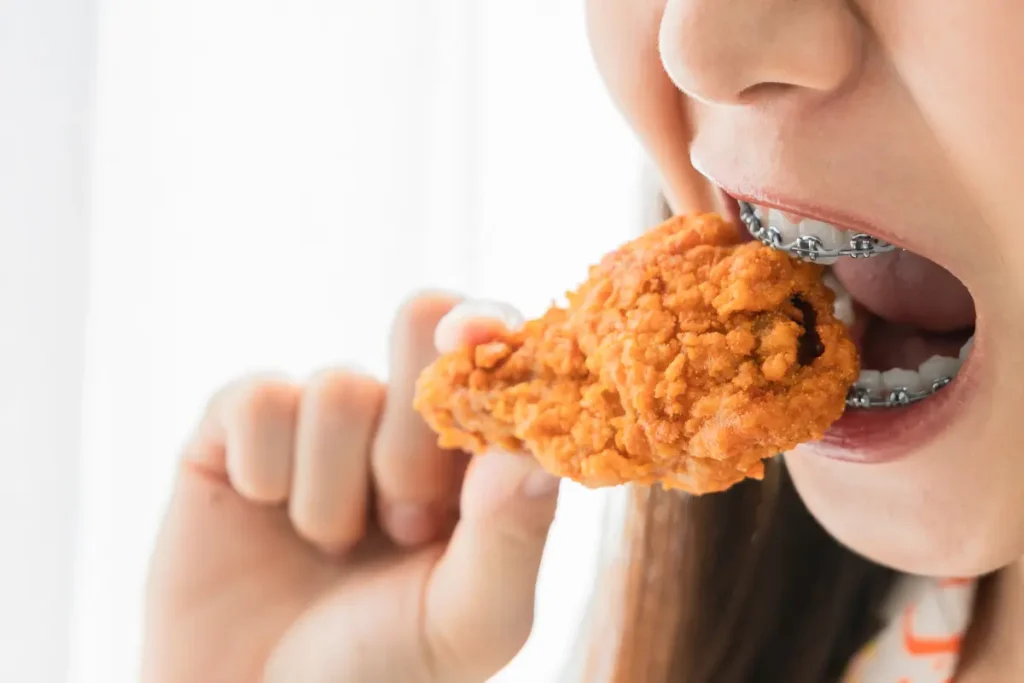 eating with braces